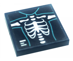 Tile 2 x 2 with Chest X-Ray Pattern (Sticker) - Set 41318